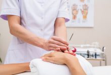 אונורי סוג'וק - דיקור קוריאני