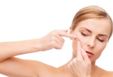 הטיפול הטבעי באקנה