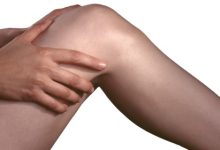 אוסטאופרוזיס