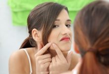 טיפול באקנה באמצעות רפואה משלימה