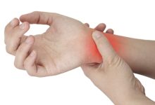 דלקת מפרקים