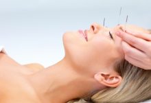 אקופנקטורה קוסמטית - דיקור סיני לפנים