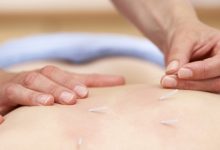 דיקור סיני - מה צריך לדעת לפני שפונים לטיפול בדיקור סיני