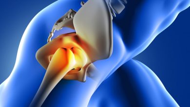 החלפת מפרק ירך בגישה קידמית. תמונה: FreePik